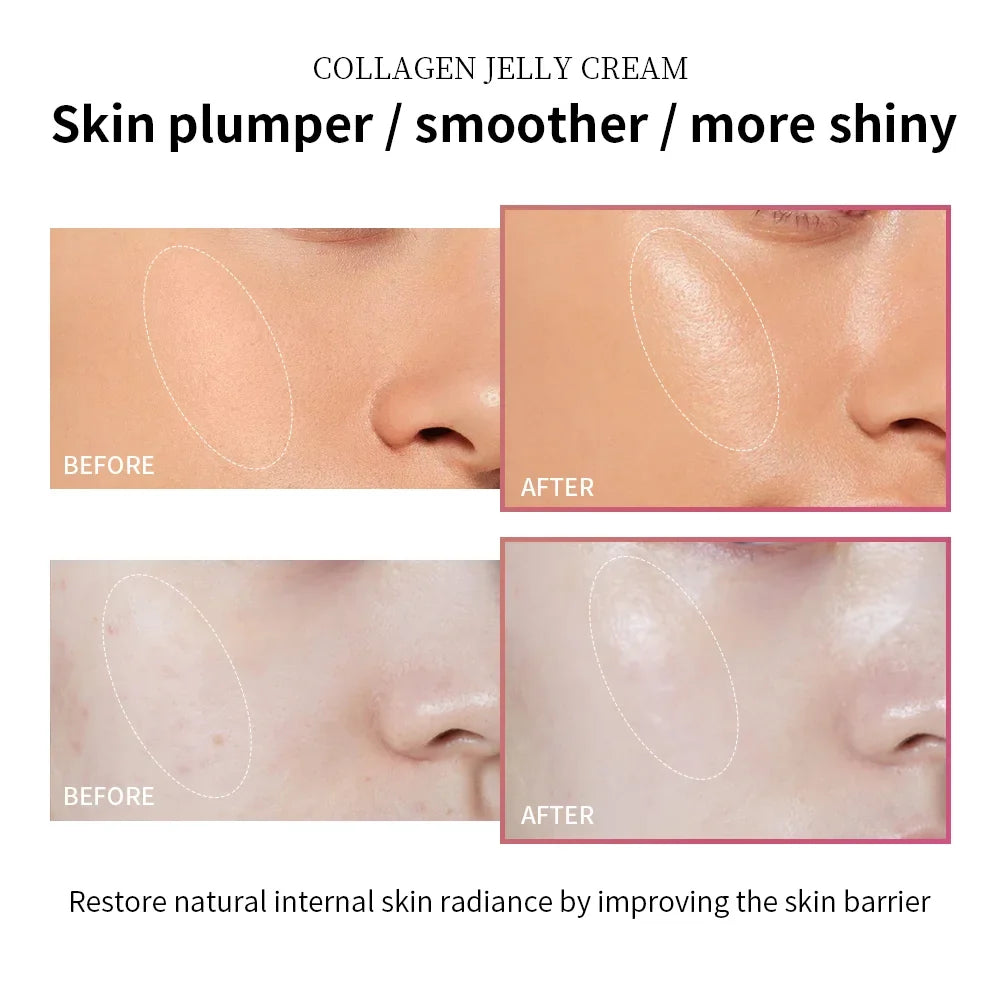 Moisturizing Collagen Jelly Cream Niacinamide Hydrolyzed Collagen Tightening Soothing Anti-Aging Firmness Hydration Skincare