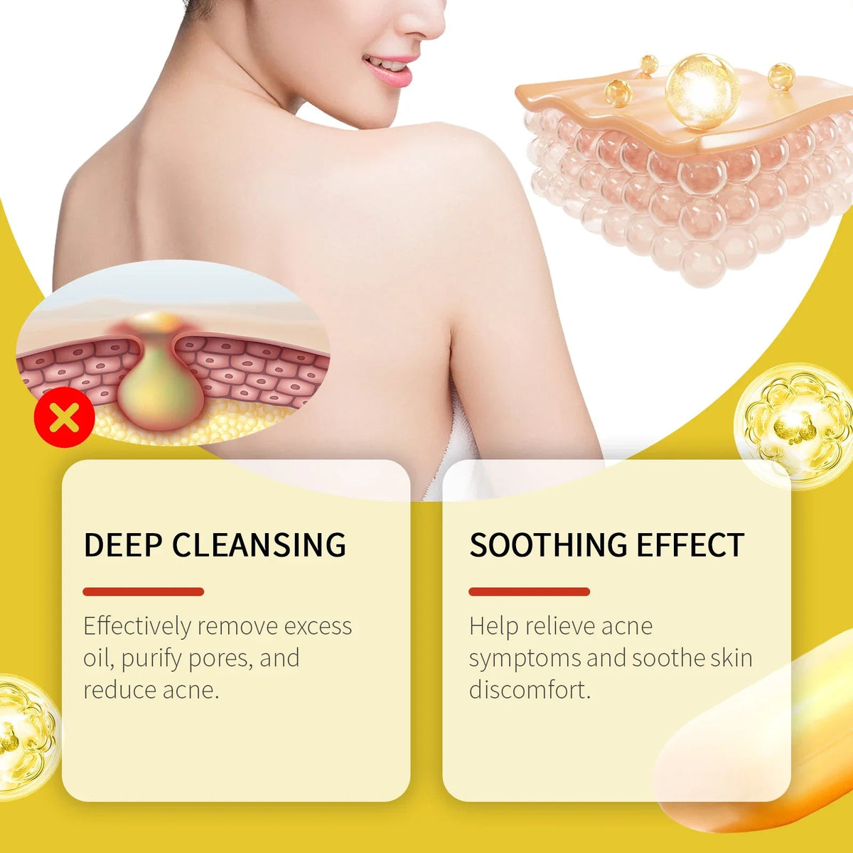 Acne Treatment Soap Pimple Remove Pigment Deep Cleansing Pores Shrink Oil Control Moisturize Body Face Lightening Skin Care Soap - JromoCompany