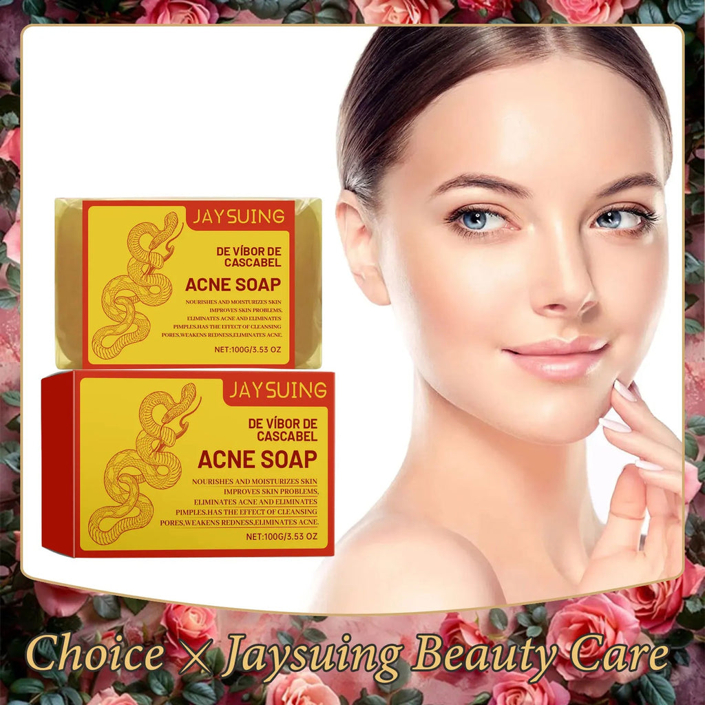 Acne Treatment Soap Pimple Remove Pigment Deep Cleansing Pores Shrink Oil Control Moisturize Body Face Lightening Skin Care Soap - JromoCompany