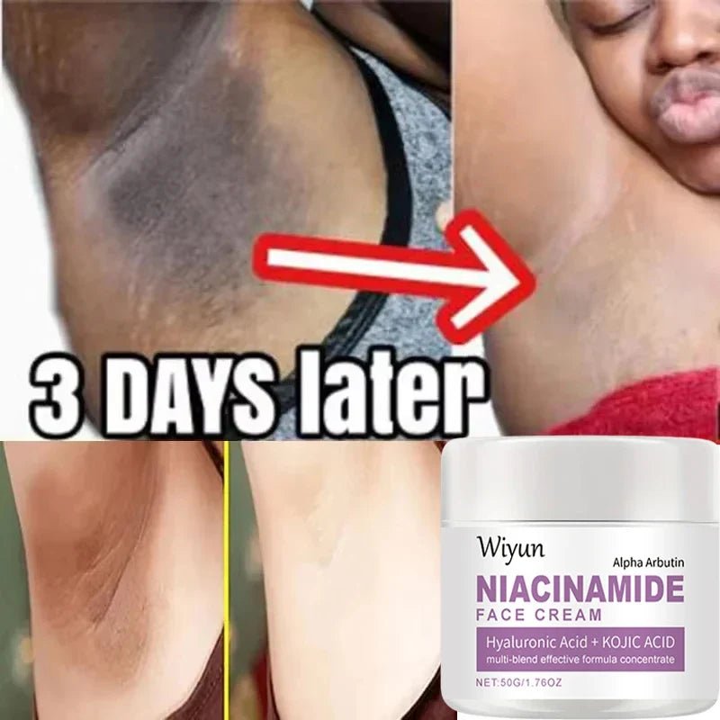 Body Whitening Cream Private Parts Underarm Bleaching Serum Whiten Butt Knee Brighten Inner Thigh Intimate Dark Remove Melanin - JromoCompany