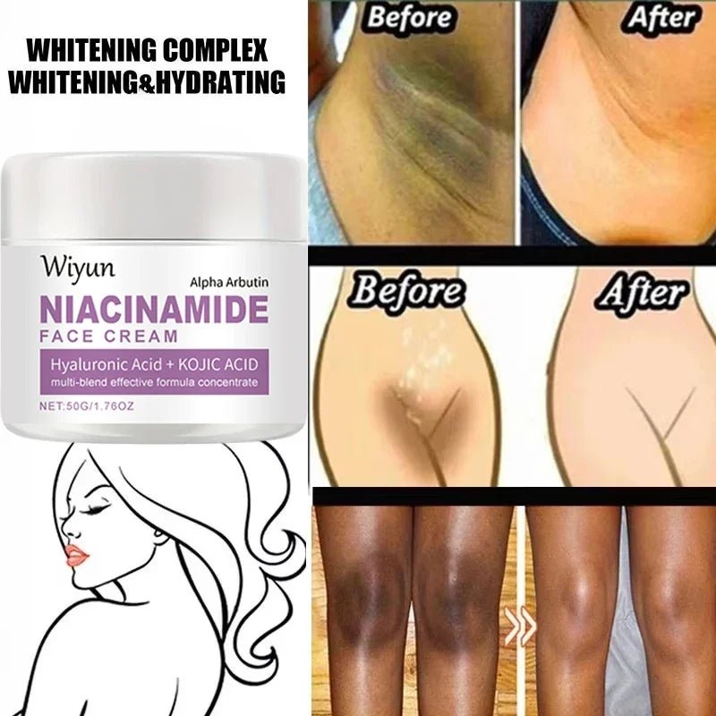 Body Whitening Cream Private Parts Underarm Bleaching Serum Whiten Butt Knee Brighten Inner Thigh Intimate Dark Remove Melanin - JromoCompany