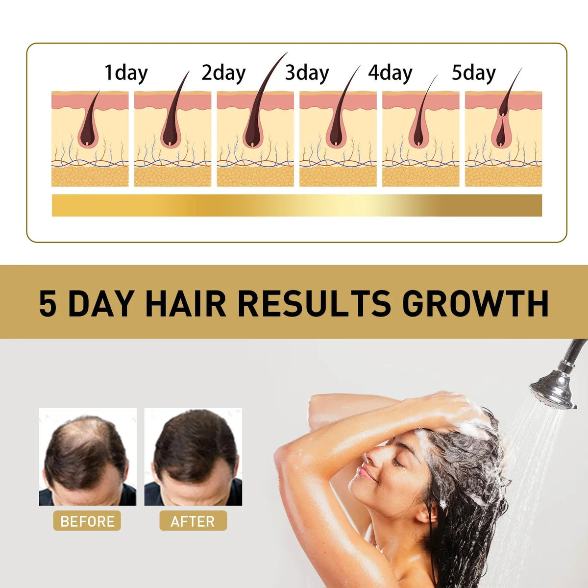 Ginger Regrowth Shampoo Anti Hair Loss Oil Control Dandruff Removal Moisturiz Nourish Scalp Repair Damaged Hair Growth Shampoo - JromoCompany